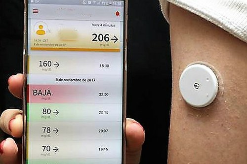 El sensor pegado al brazo de una persona y, junto a él, su teléfono móvil reflejando la información de nivel de glucosa