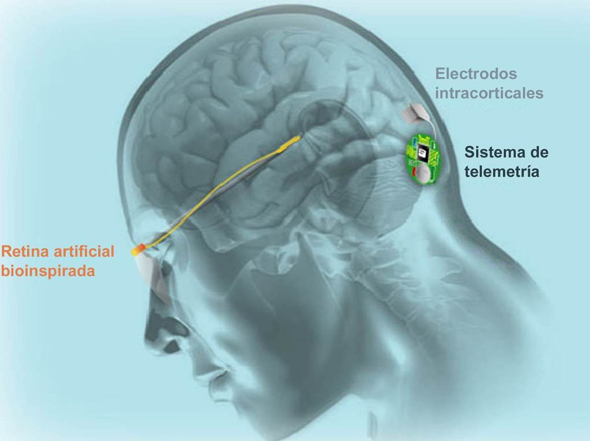 Croquis representativo de la neuroprótesis visual que investiga el equipo ilicitano