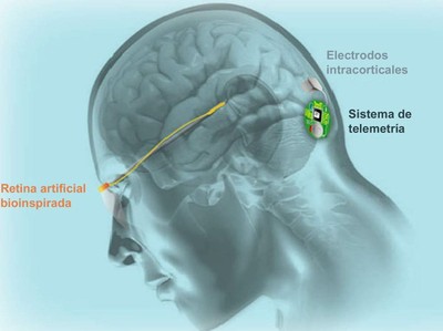 Croquis representativo de la neuroprótesis visual que investiga el equipo ilicitano